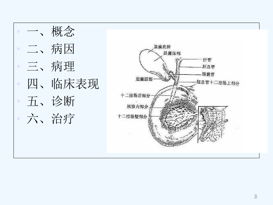 急性梗阻性化脓性胆管炎-课件.ppt_第2页