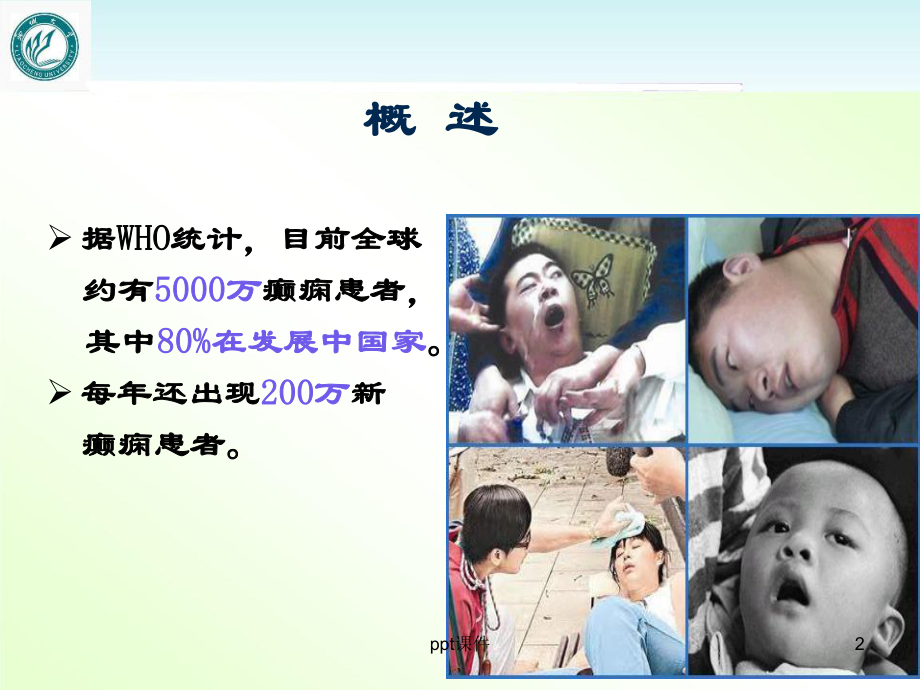 抗癫痫药-课件.ppt_第2页