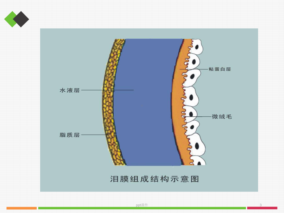 干眼症的诊治-课件.ppt_第3页