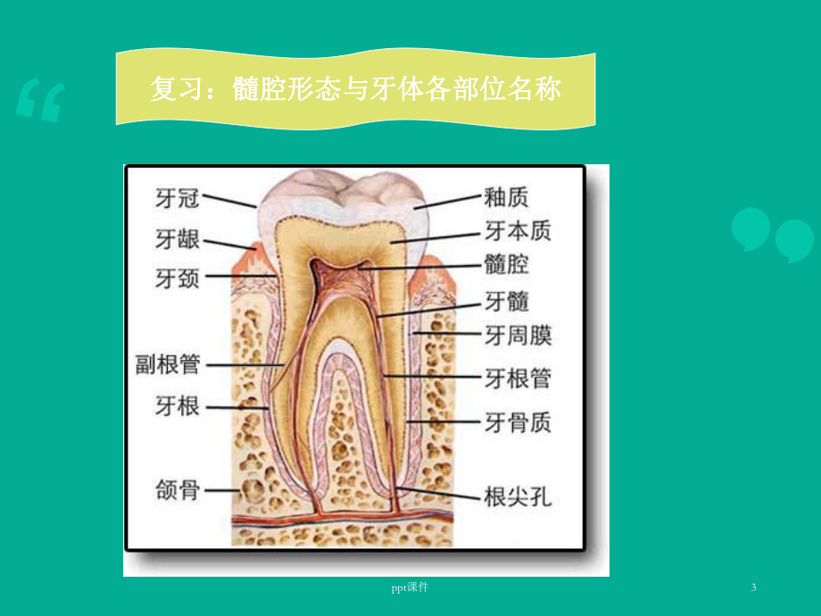 急性牙髓炎-课件.ppt_第3页