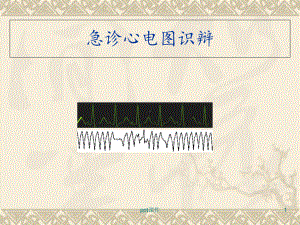 急诊心电图识辩-课件.ppt