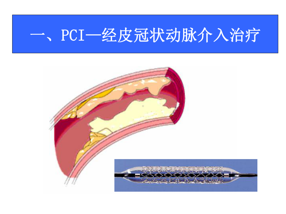 心脏康复指南学习月日课件.ppt_第3页