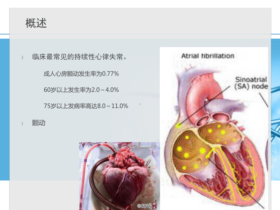 心房颤动课件(同名136).ppt_第2页