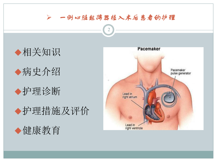 心脏起搏器植入术后患者的护理课件.ppt_第2页