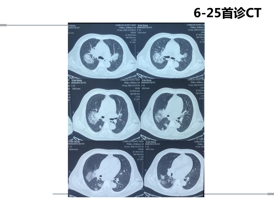 感染规范诊疗思路课件.pptx_第3页