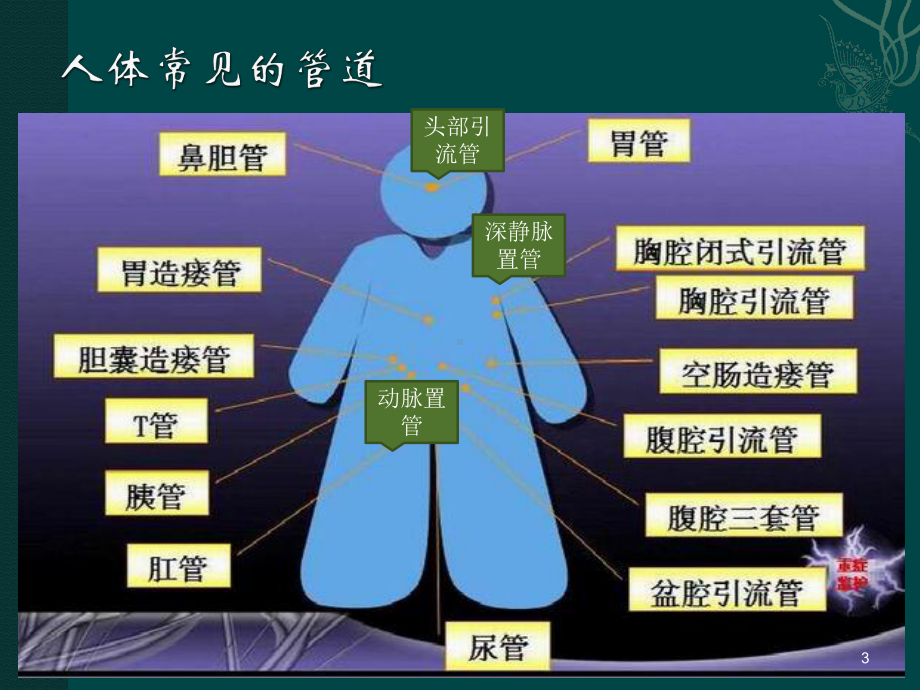 常见管道护理课件-参考.ppt_第3页