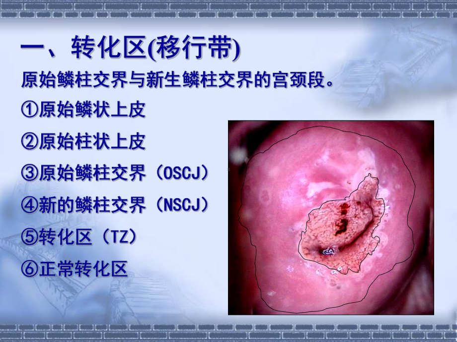 宫颈病变几个重要概念及问题课件.ppt_第3页