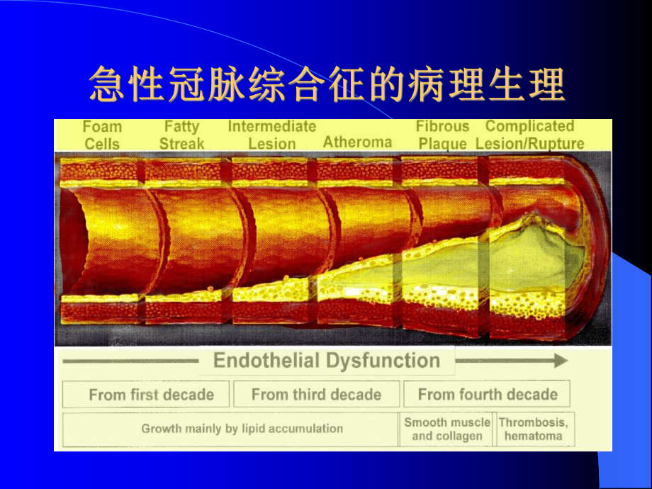 急性冠脉综合征诊断与治疗课件.ppt_第2页