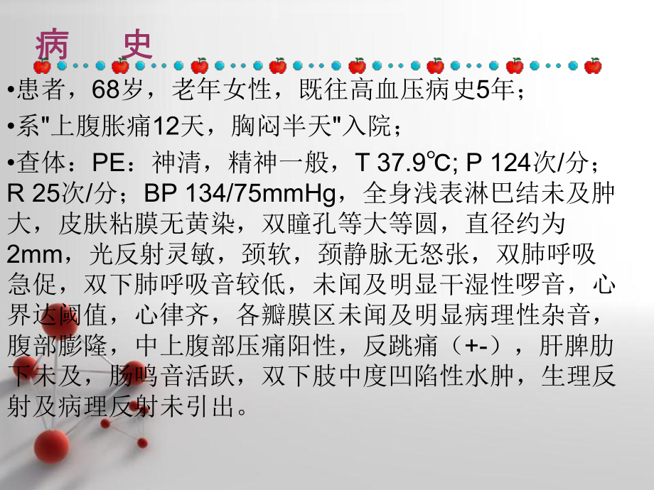 急性胰腺炎护理查房-课件.ppt_第3页