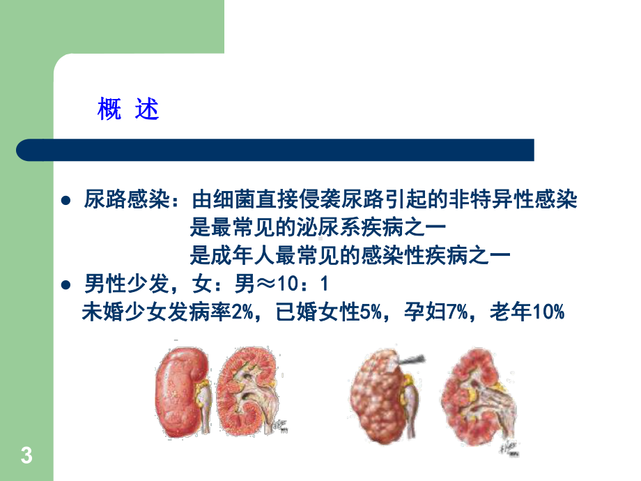 尿路感染课件-参考.ppt_第3页