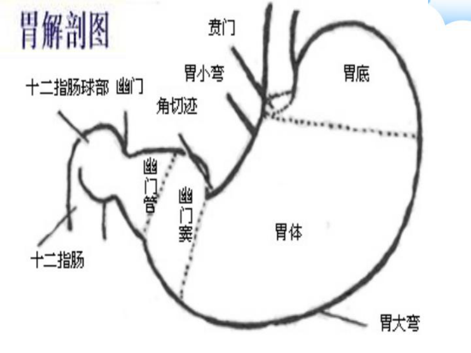 常见胃肠道疾病的营养治疗-课件.ppt_第3页