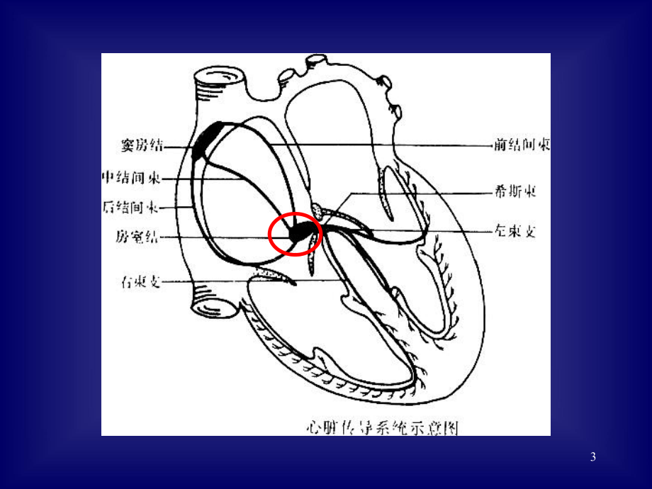 心律失常总结课件.ppt_第3页