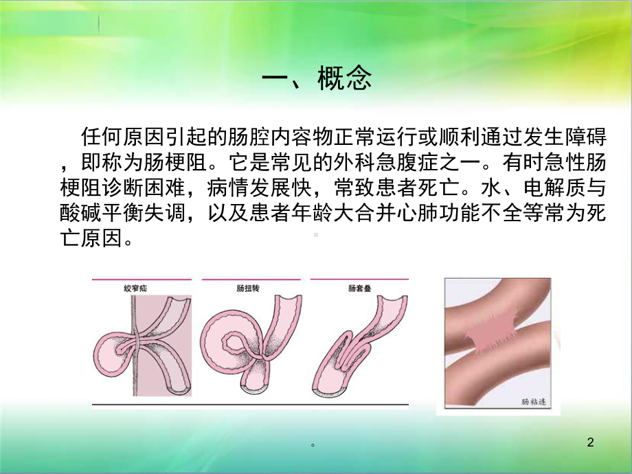 新版肠梗阻护理常规-医学课件(精选).ppt_第2页