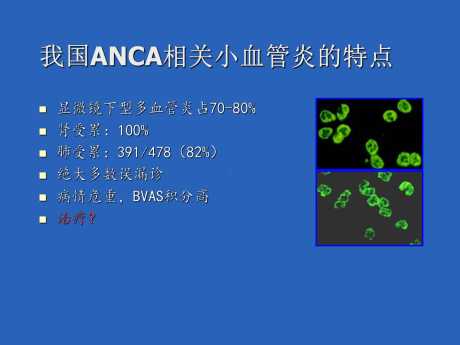 最新anca相关性血管炎诊疗进展汇总课件.ppt_第3页