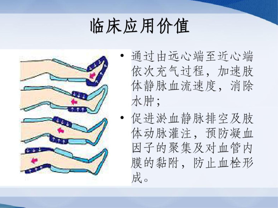 气压治疗仪的使用课件.ppt_第2页