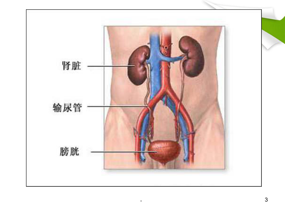 新版膀胱肿瘤的护理培训课件.ppt_第3页