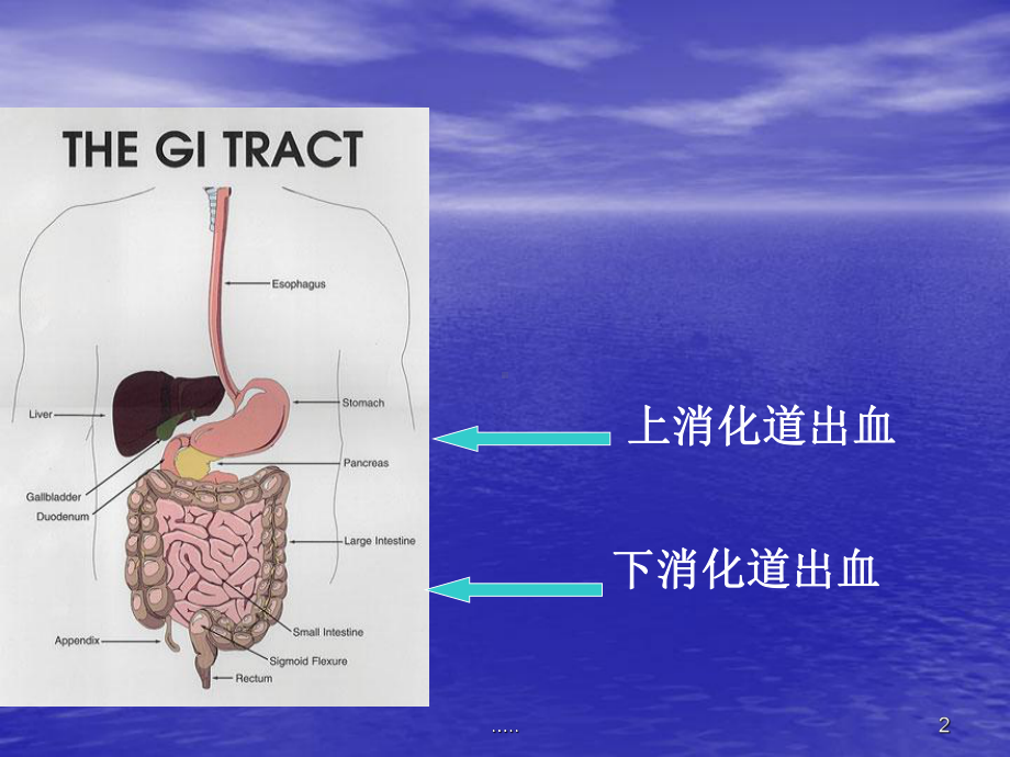 消化道出血的急救与护理归纳课件.ppt_第2页