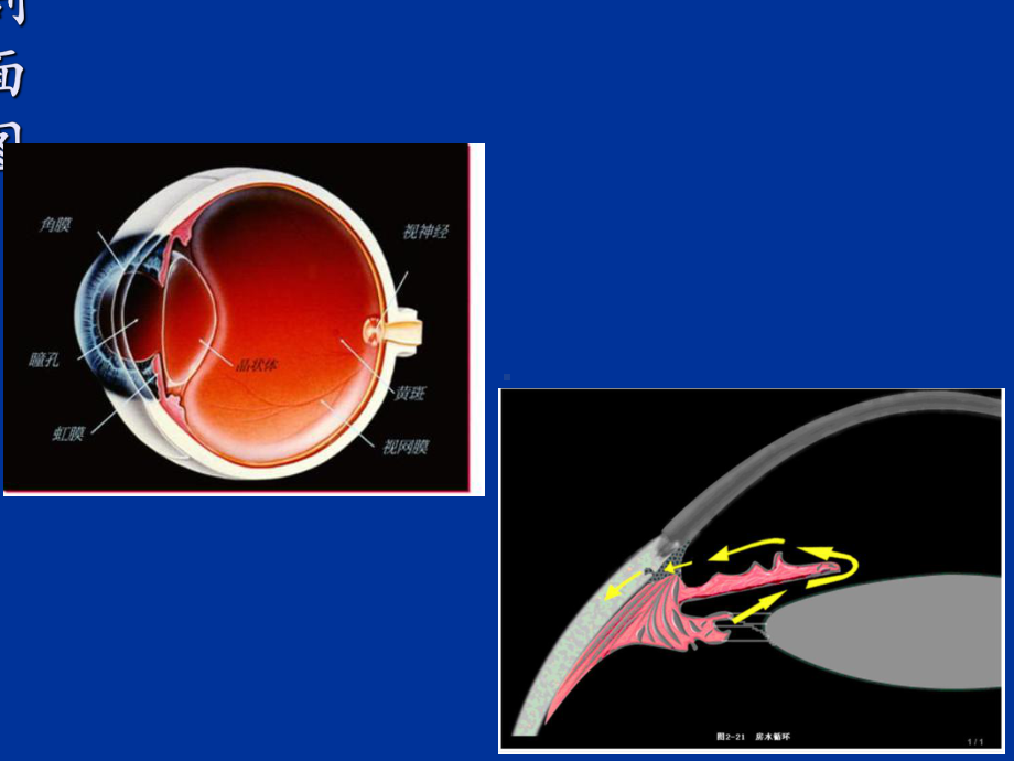 急性闭角型青光眼的诊断与治疗课件.ppt_第3页