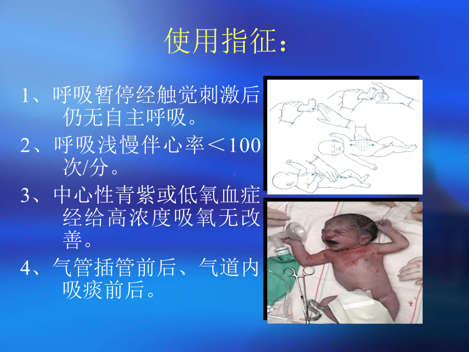 复苏囊的使用培训资料课件.ppt_第3页