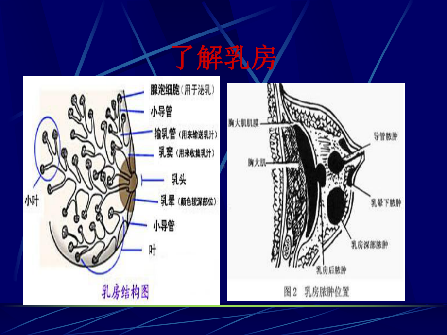 急性乳腺炎的护理课件.pptx_第3页