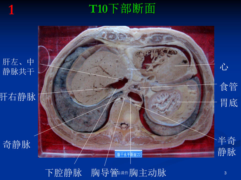 断层解剖课件.ppt_第3页