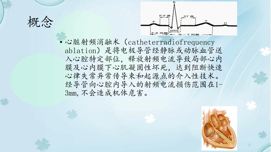 心脏射频消融术(课件).ppt_第2页