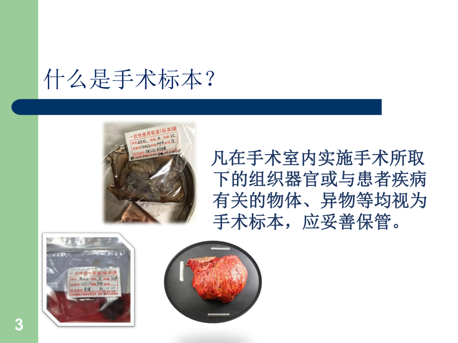 手术室标本管理(课件).ppt_第3页