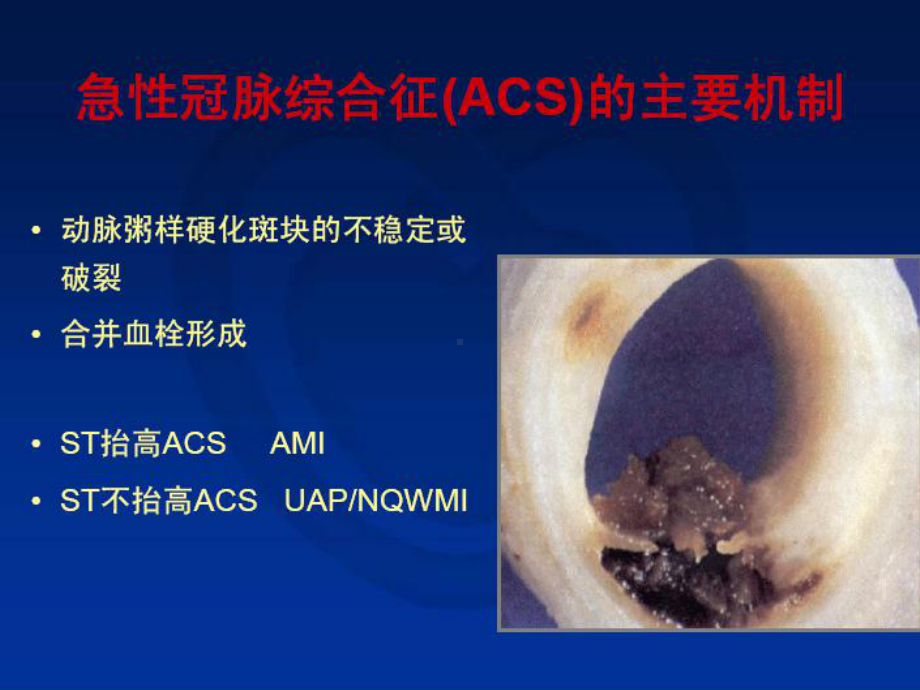 有效防治血栓规避出血风险课件.ppt_第3页