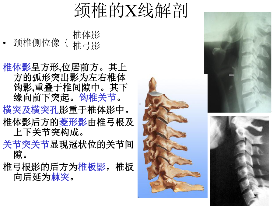 新版脊柱的X线解剖课件.ppt_第2页