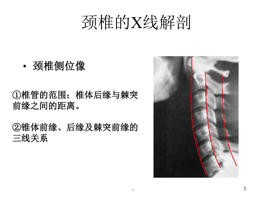 新版脊柱的X线解剖课件.ppt_第3页