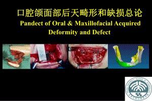 口腔颌面外科学：口腔颌面部后天畸形和缺损总论课件.ppt