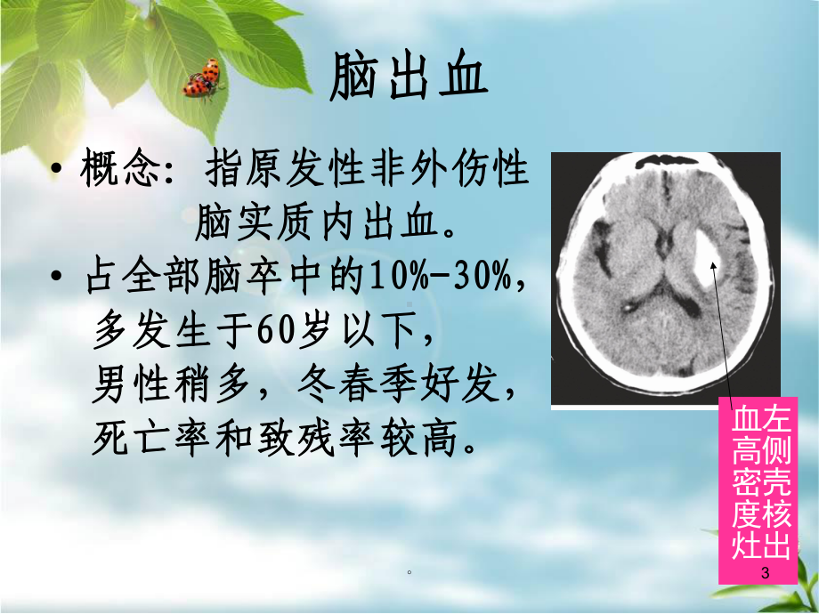 新版脑出血恢复期患者的护理培训课件.ppt_第3页