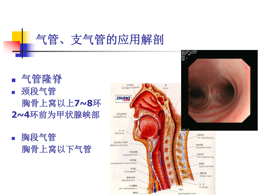 耳鼻喉21气管食管异物.pptx_第3页