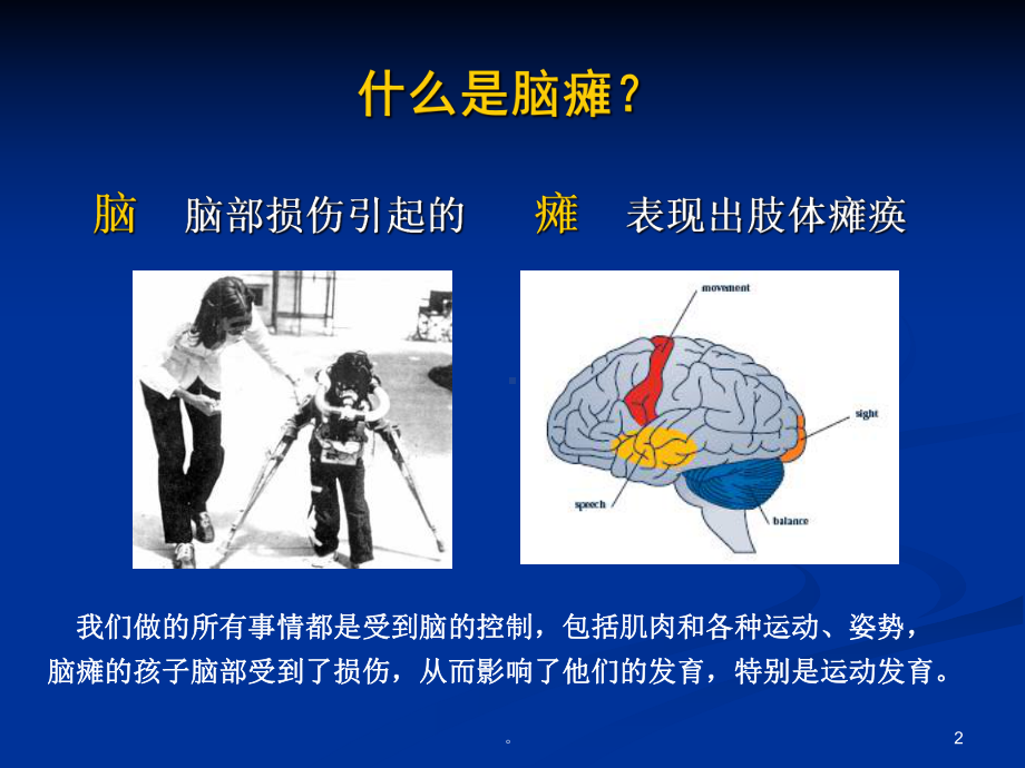 新版脑瘫基础知识与康复治疗培训课件.ppt_第2页