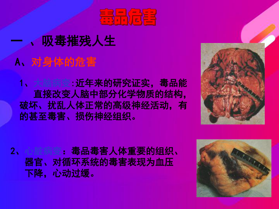 小学主题班会课件：珍爱生命远离毒品.ppt_第2页