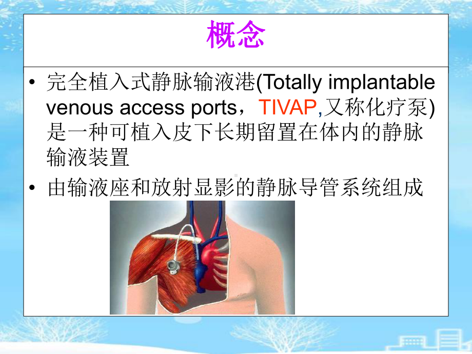 植入式静脉输液港的护理2021完整版课件.ppt_第2页