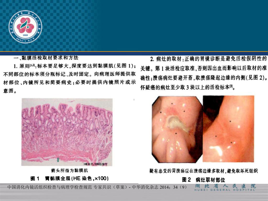 消化内镜病检教材课件.ppt_第3页