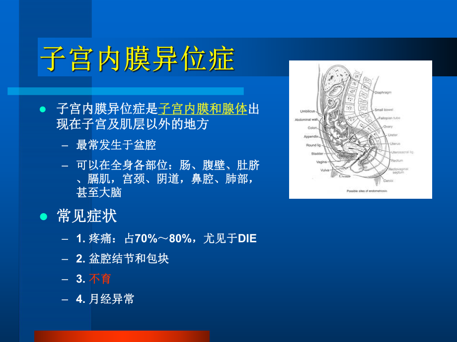 朱依敏子宫内膜异位症性不孕症诊治0-下午杭州课件.ppt_第2页