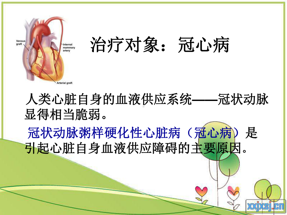 激光心肌血管重建术--北京理工大学讲解课件.ppt_第2页