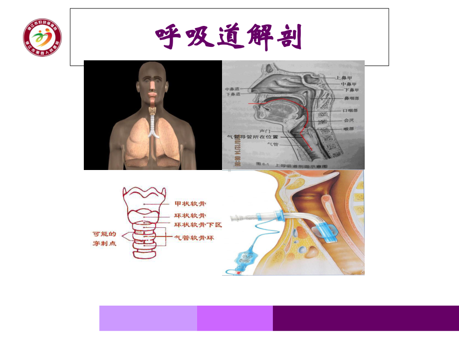 气管切开气囊的管理课件.ppt_第3页