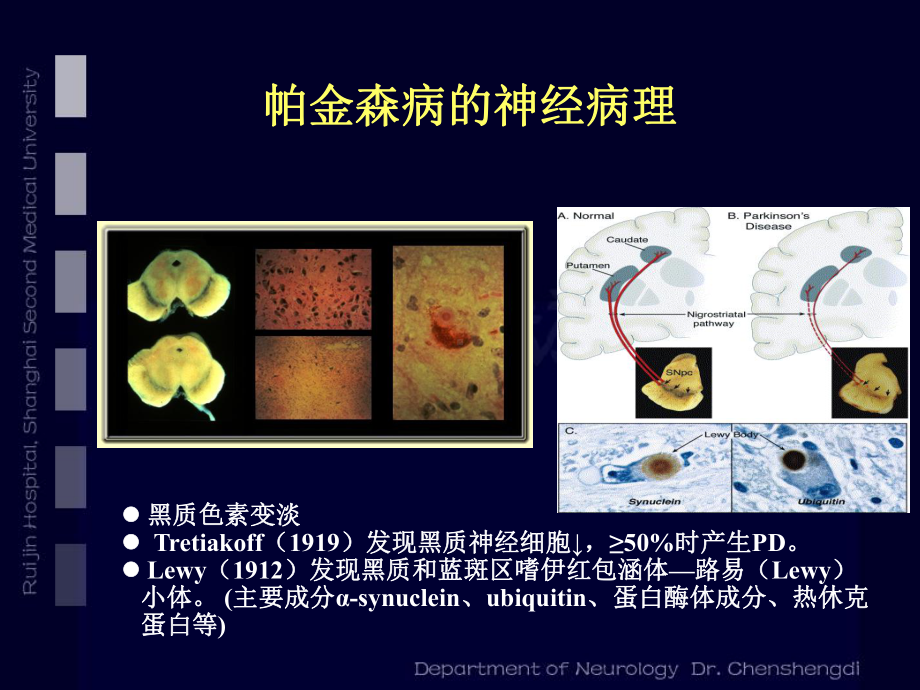 王增：帕金森病诊断与治疗策略课件.ppt_第2页