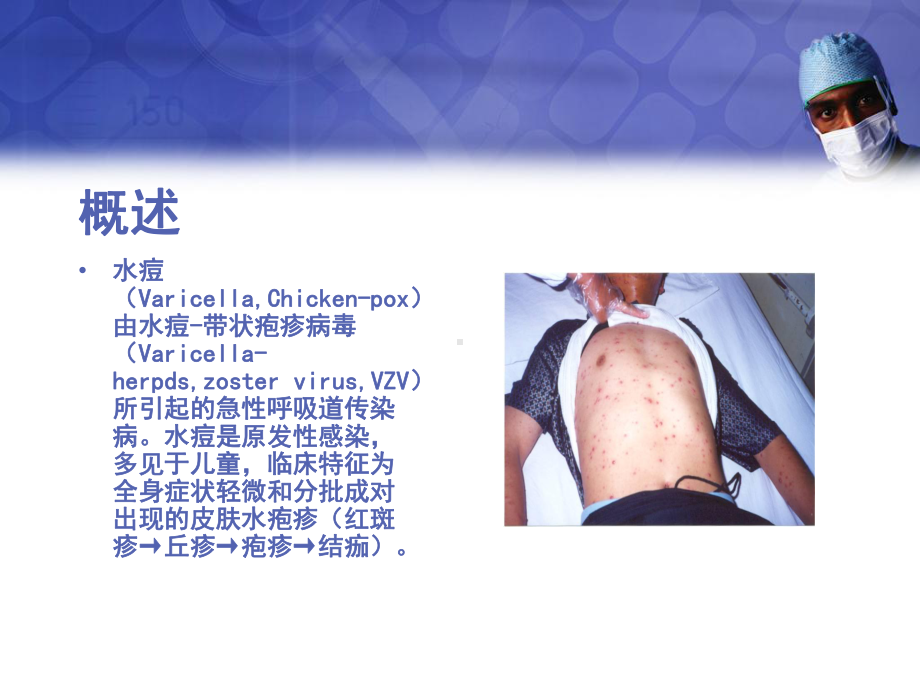 水痘(Varicella)教学讲解课件.ppt_第2页