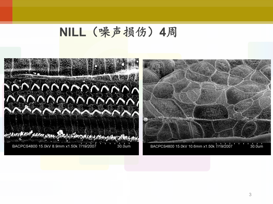 耳内-耳聋生物学治疗的挑战与实践-课课件.ppt_第3页