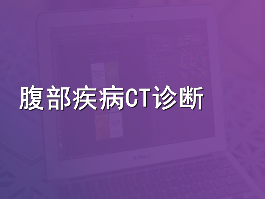 腹部疾病CT诊断-课件.ppt_第1页