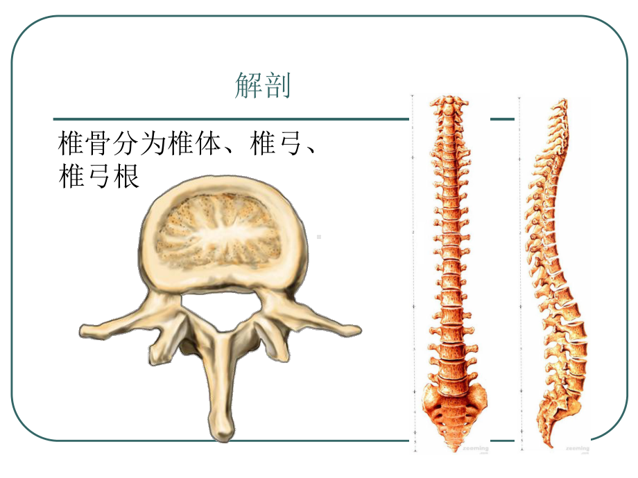 腰椎骨折课件-参考.ppt_第2页