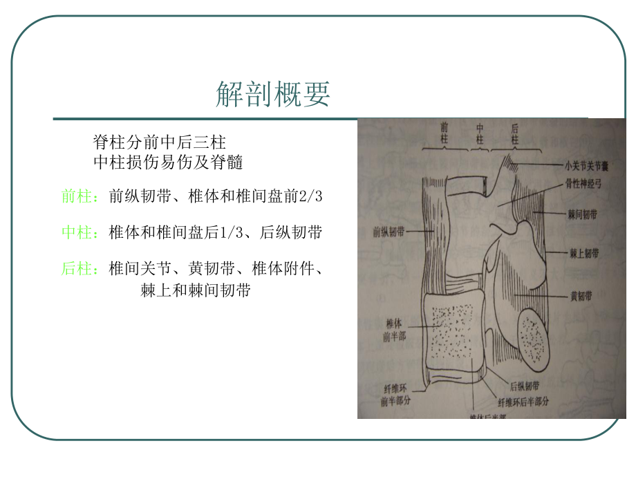 腰椎骨折课件-参考.ppt_第3页