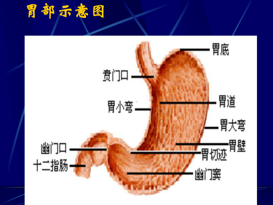 胃癌消化内科课件.ppt_第3页