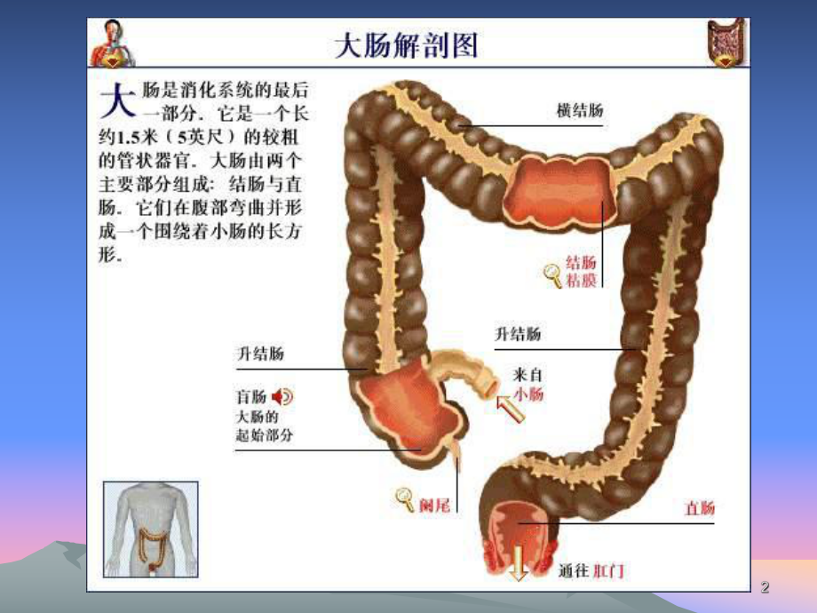 直肠癌的护理课件-整理.ppt_第2页