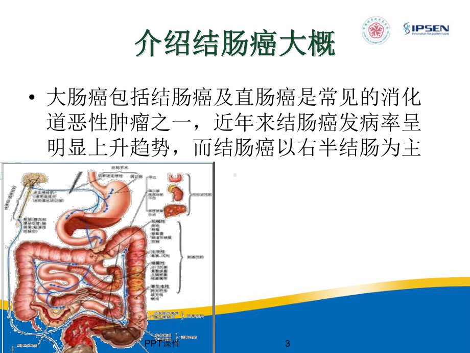 结肠癌教学查房-课件.ppt_第3页