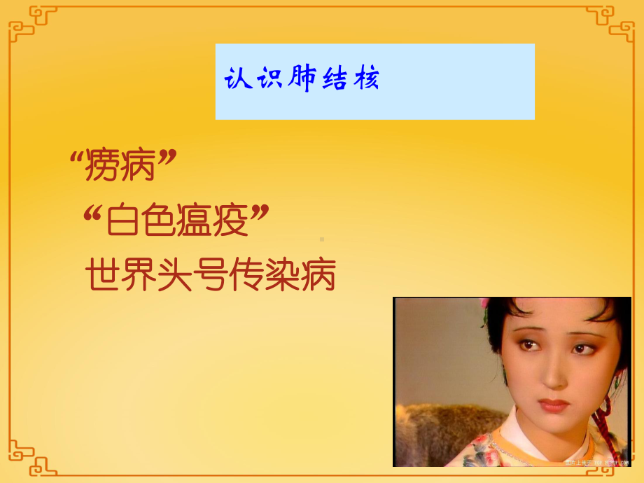 肺结核病人的护理-课件.ppt_第2页